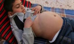 2000 إصابة بـ